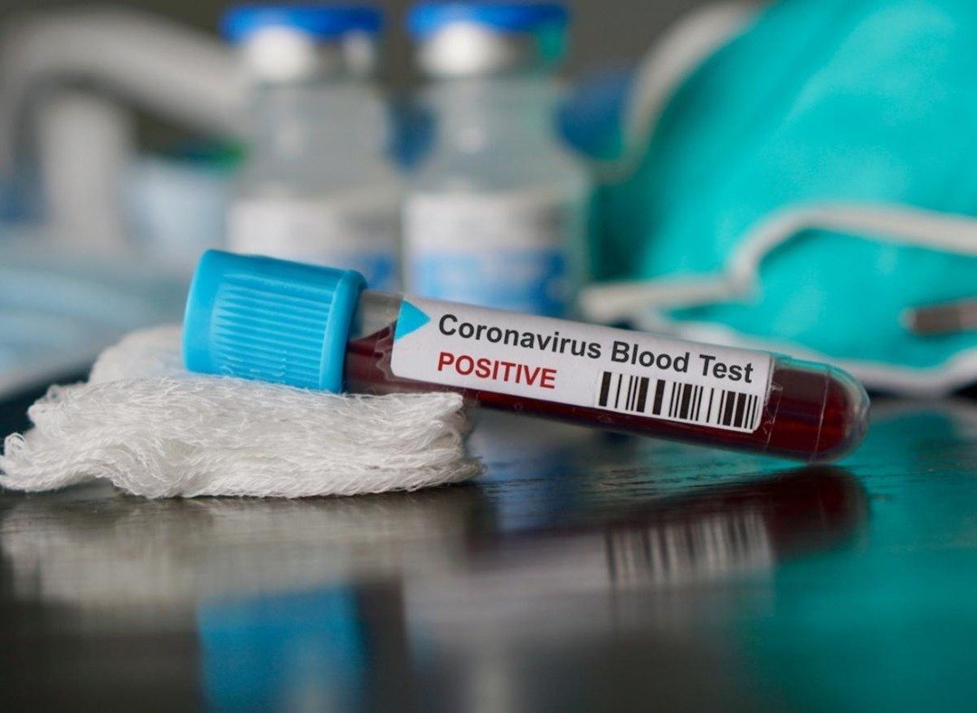 Covid-19 (20 DEC) : 8 décès, 164 guérisons et 140 nouvelles contaminations