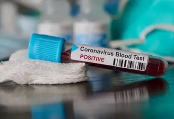 Covid-19 "5 MAI 2021" : 1 décès, 39 cas positifs et 32 cas guéris