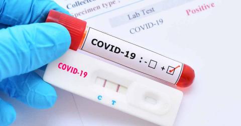 Covid-19 : 13 cas positifs enregistrés au cours des dernières 24 heures