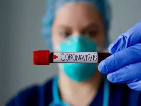 Covid-19 "17 AVRIL 2021" : 0 décès, 18 contaminations et 7 guérisons