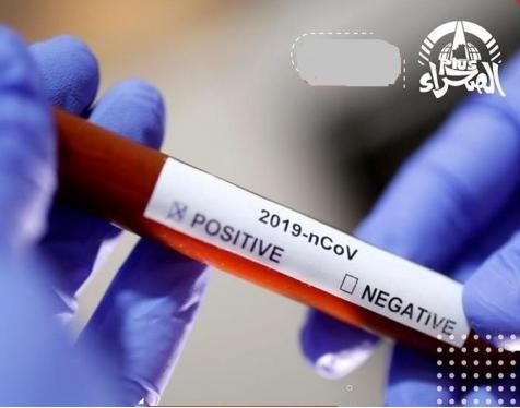 Covid-19 : un décès et 13 nouvelles contaminations enregistrés
