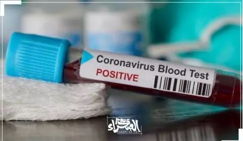 Covid-19 : 3 nouvelles contaminations et 5 guérisons enregistrées