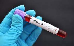 Covid-19 : 23 nouvelles contaminations enregistrées en 24 heures
