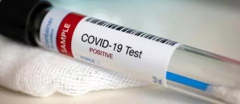 Covid-19 :près de 40 nouvelles contaminations enregistrées en 24 heures